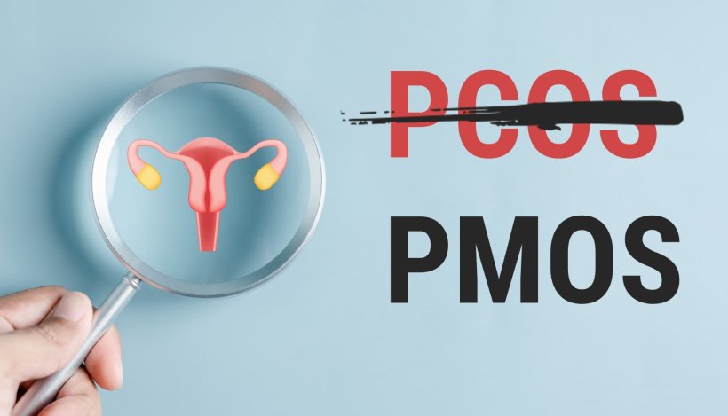 PCOS and Weight Management: A Complete Guide to Healthy Living